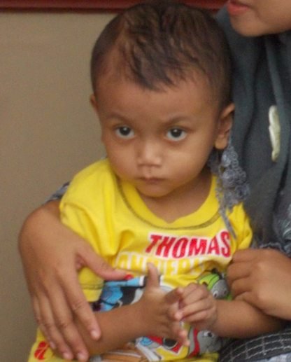 Epilepsi Seharusnya Sembuh 5 Tahun Lagi, Ternyata Bisa Cepat dengan Produk Perlebahan