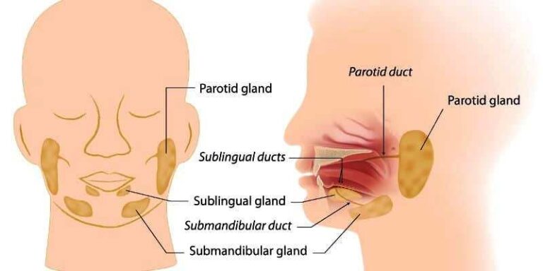 Tumor Parotis Menjadi Kanker Parotis Stadium 2 dan Kanker Kelenjar Getah Bening
