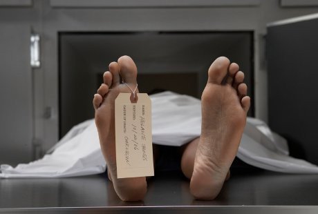 Patut Waspada, Epilepsi Juga Bisa Sebabkan Kematian Mendadak