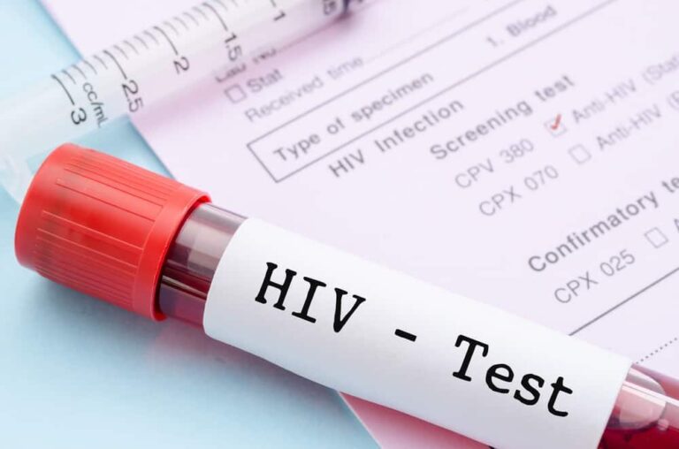 Apakah Test HIV/AIDS Sekarang Ini Akurat?