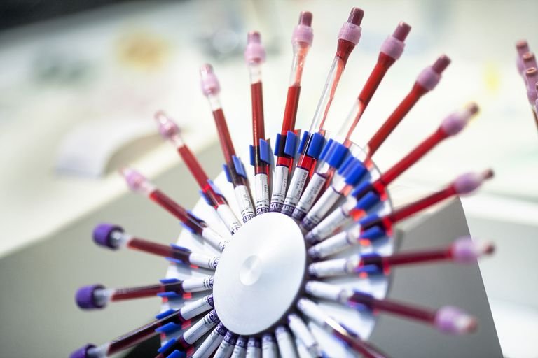 Banyak Kondisi Non-AIDS yang Bisa Menyebabkan CD4 Rendah