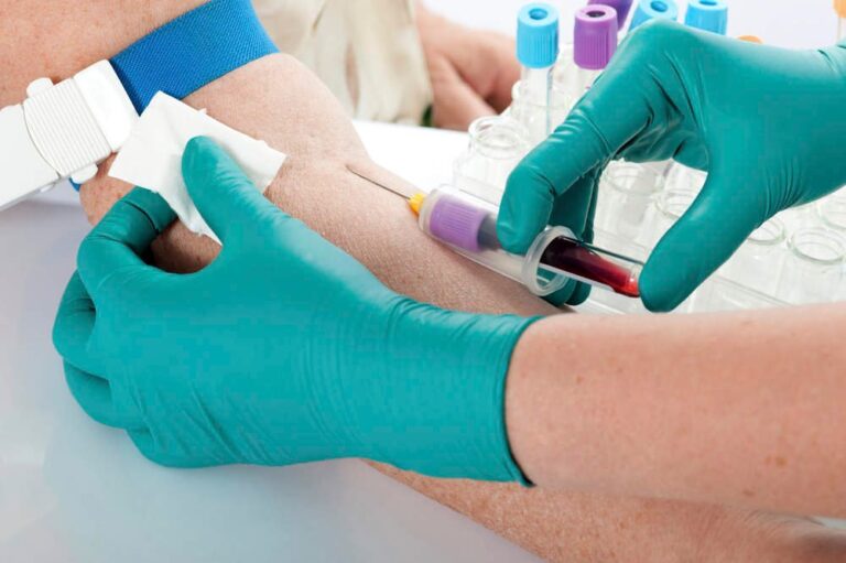 Ini yang Perlu Anda Ketahui Tentang Medical Check-Up