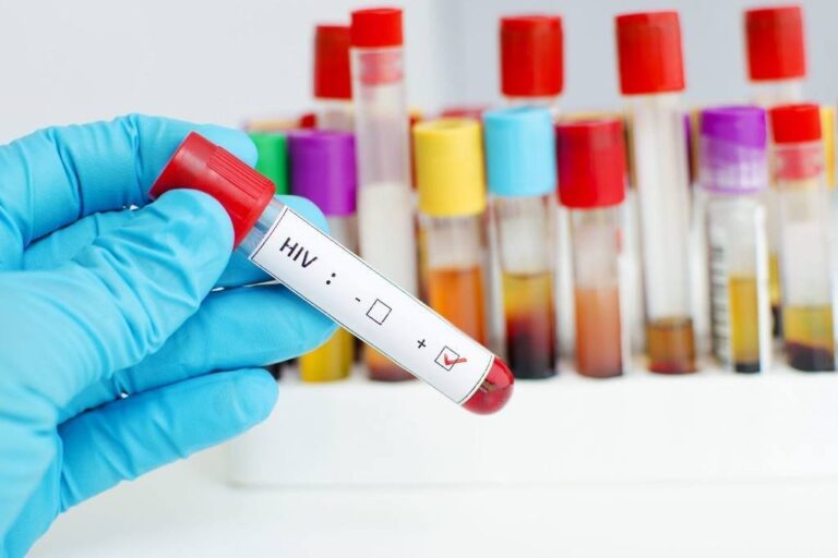 Mitos HIV Sekitar Viral Load dan Sel T