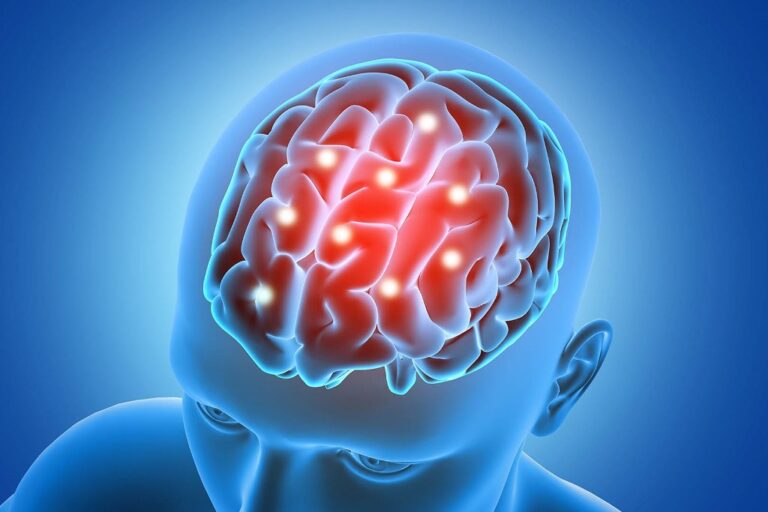 Berbagai Obat Alami untuk Meningitis