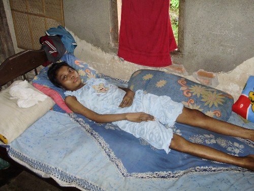 Proyek HIFON 01 – Pasien Lupus, Ketut Suarningsih, Bali