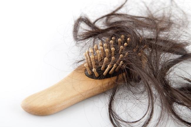 Inilah Penyebab Rambut Rontok Berlebihan